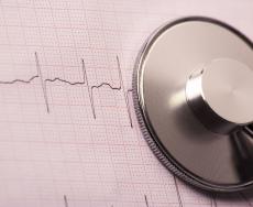 Disturbi del ritmo cardiaco: la fibrillazione atriale è il più frequente