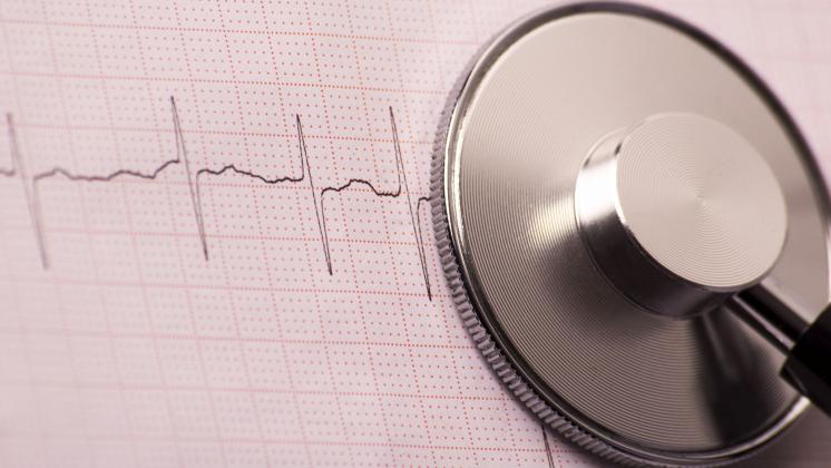 Disturbi del ritmo cardiaco: la fibrillazione atriale è il più frequente