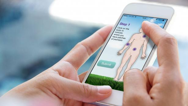 Grazie a un'app è più semplice monitorare la psoriasi